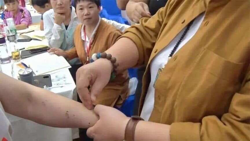 董氏奇穴祛湿三剑客：阴陵泉、三阴交、丰隆穴
