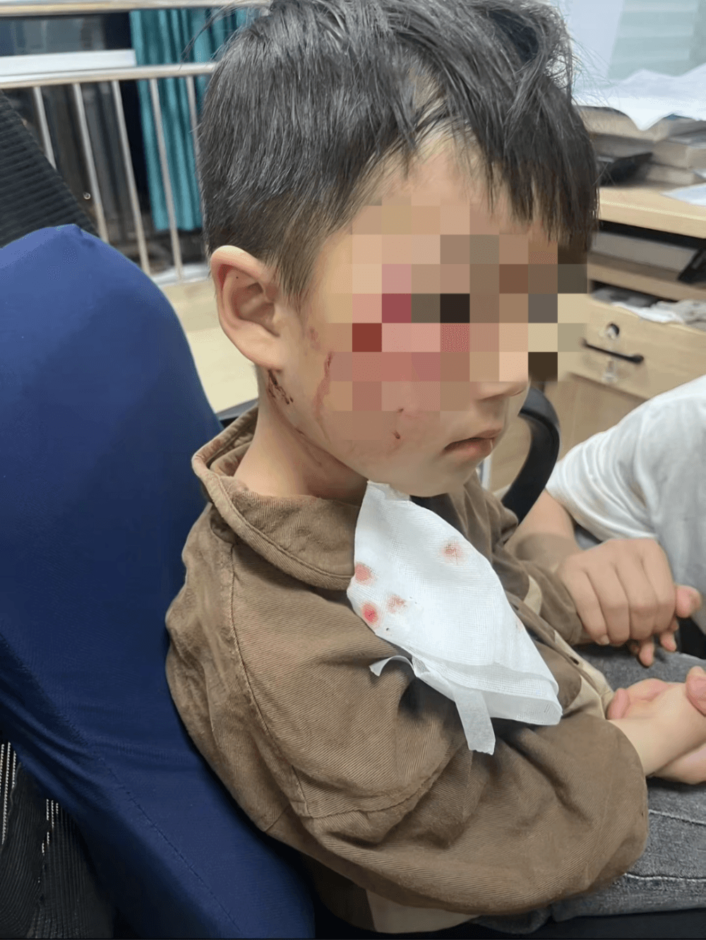 “狂犬病疫苗无法保证不感染”，三岁男童被狗咬伤离世，调查结果公布
