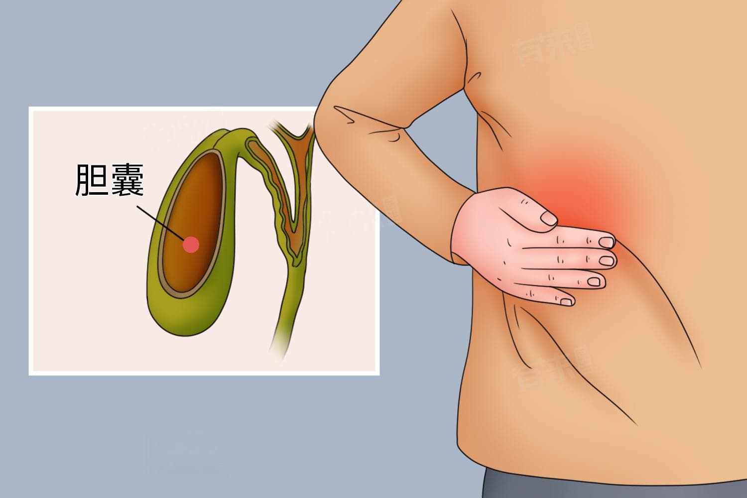 胆囊疼痛怎么缓解最快