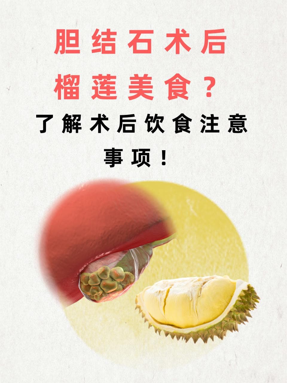 胆结石术后饮食指南：榴莲能吃吗？这些食物需谨慎
