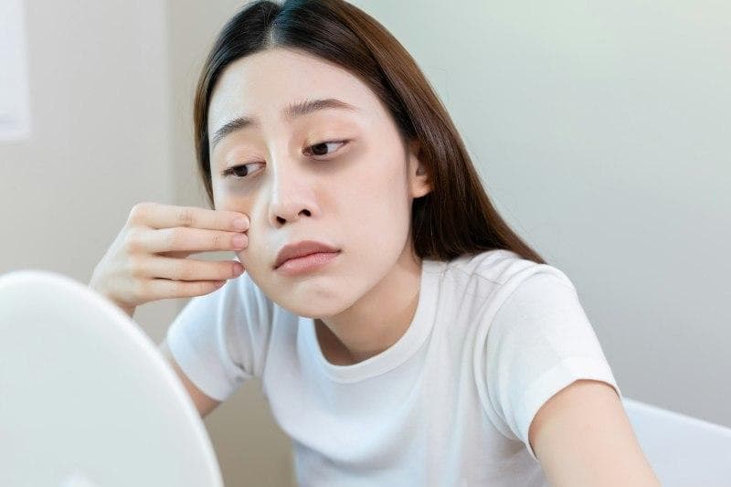 中医角度解析黑眼圈：气血失调与调理之道