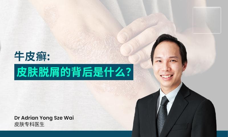 牛皮癣: 皮肤脱屑的背后是什么？
