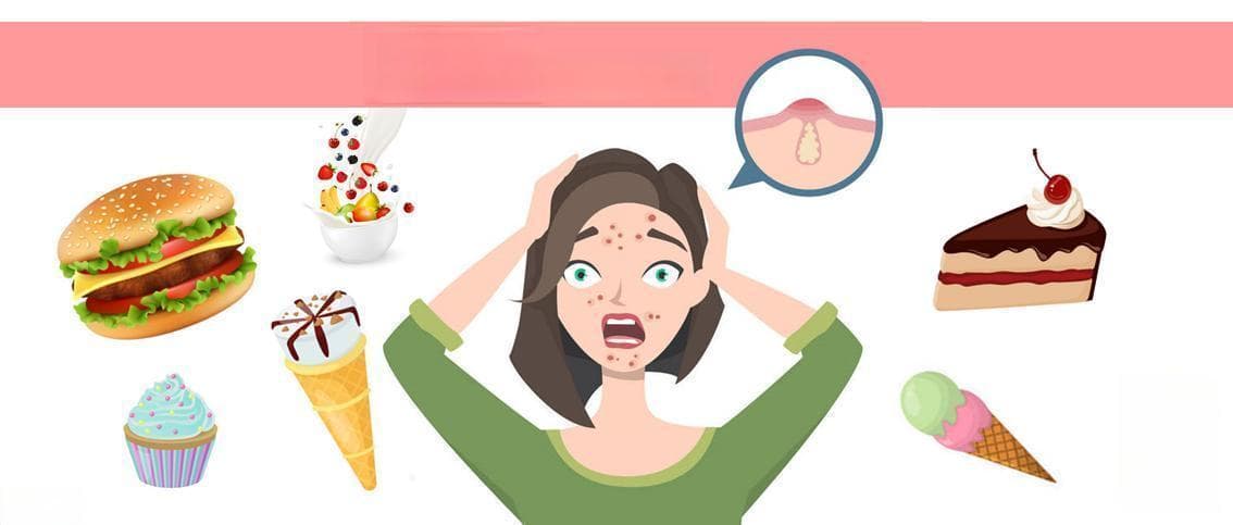 这7种类型的食物可能引起 “痘痘”