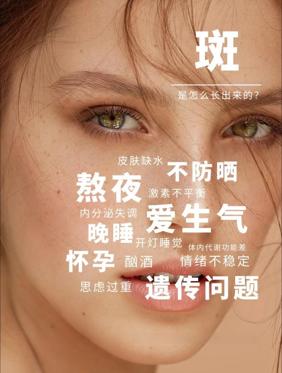 揭秘色斑的形成与去除：护肤新手指南