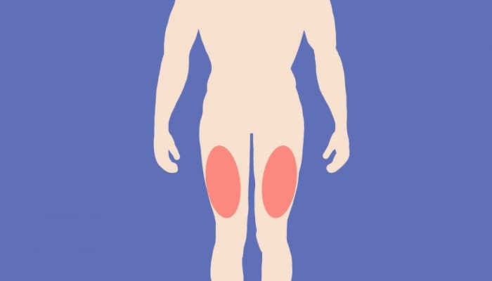 大腿外侧有什么穴位？右大腿外侧麻木怎么回事？
