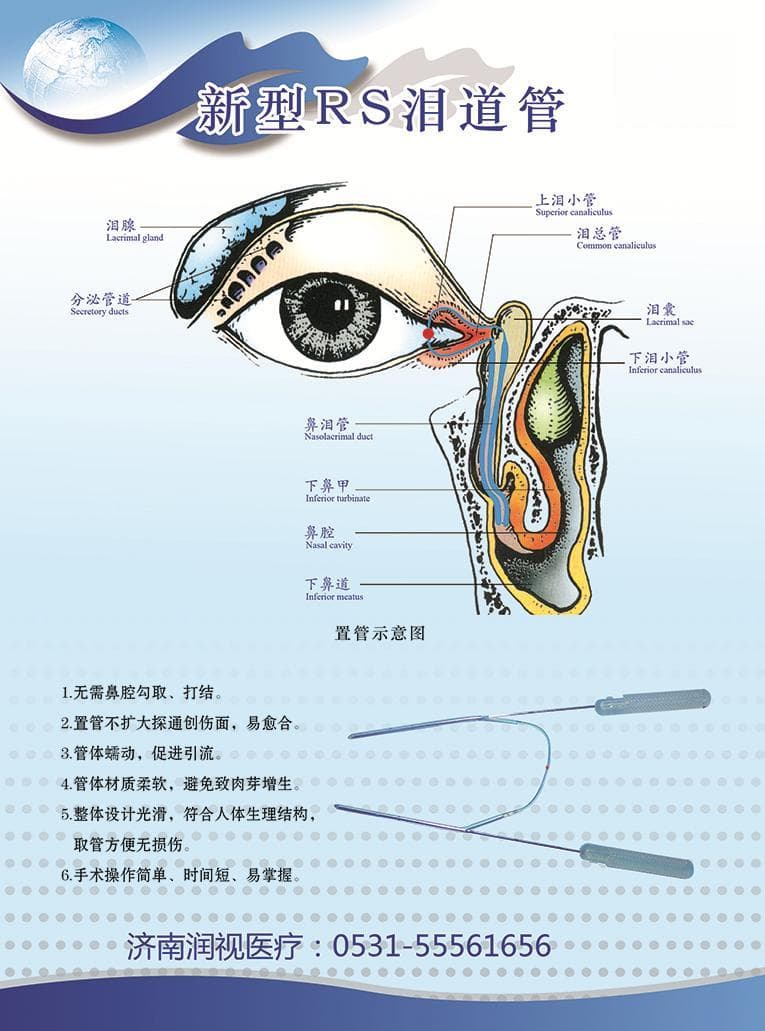 迎风流泪是病吗