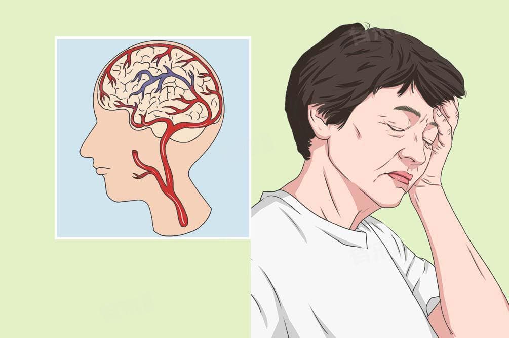 后循环缺血是什么病