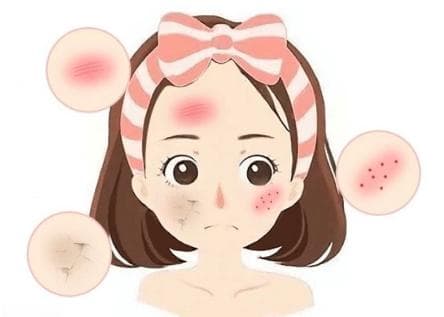 告别敏感肌困扰：温和护理与生活调整双管齐下