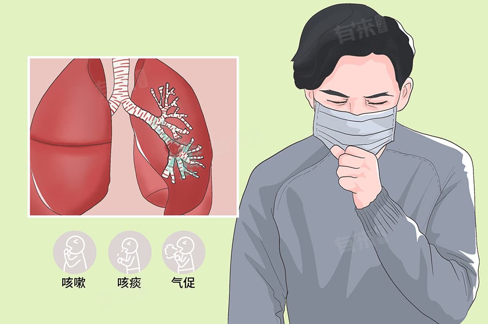 肺部肿瘤是手术好还是保守治疗好呢