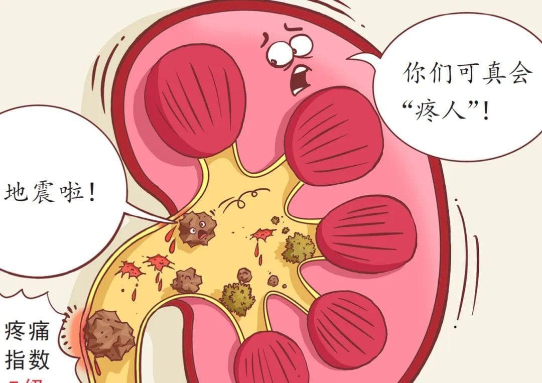 尿液结晶成石，肾结石来袭！8类人要当心，专家支招预防