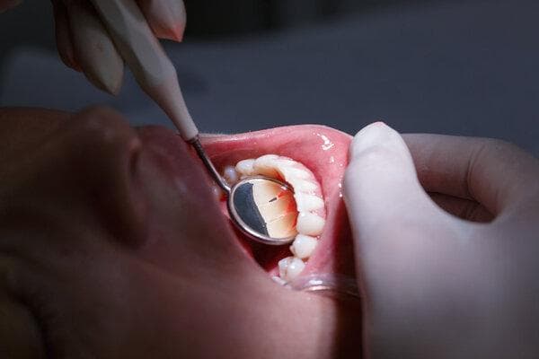 腮腺肿瘤挂什么科室诊断好呢