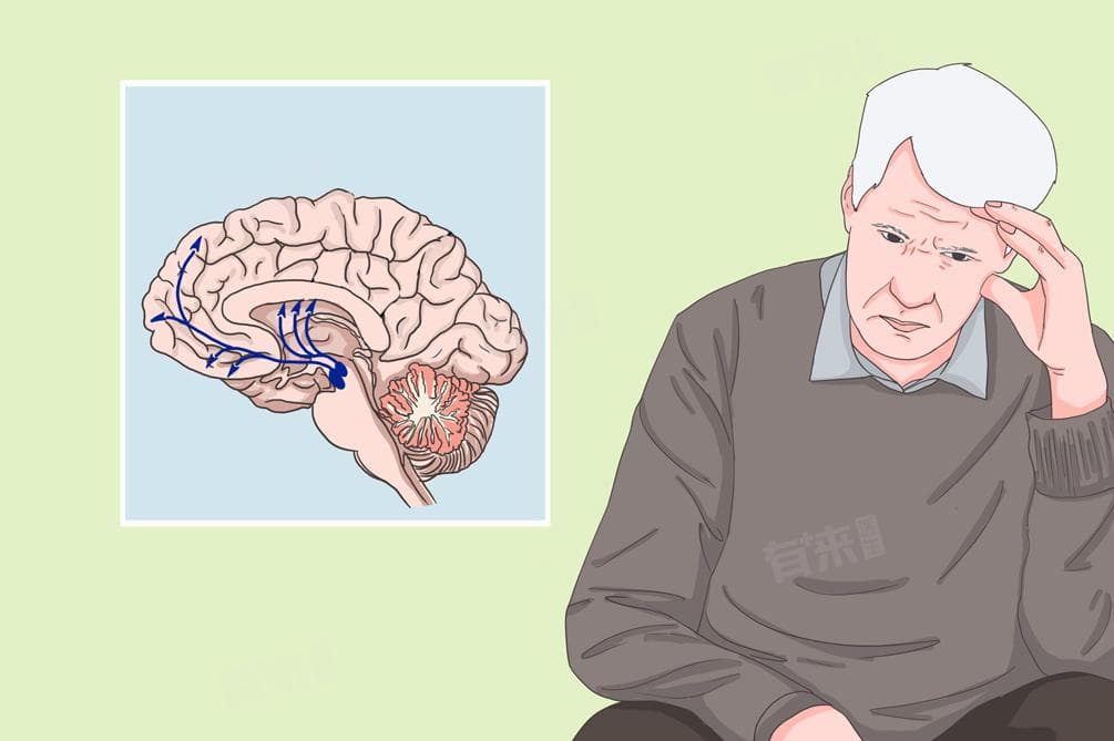 帕金森病患者应该挂哪个科室？
