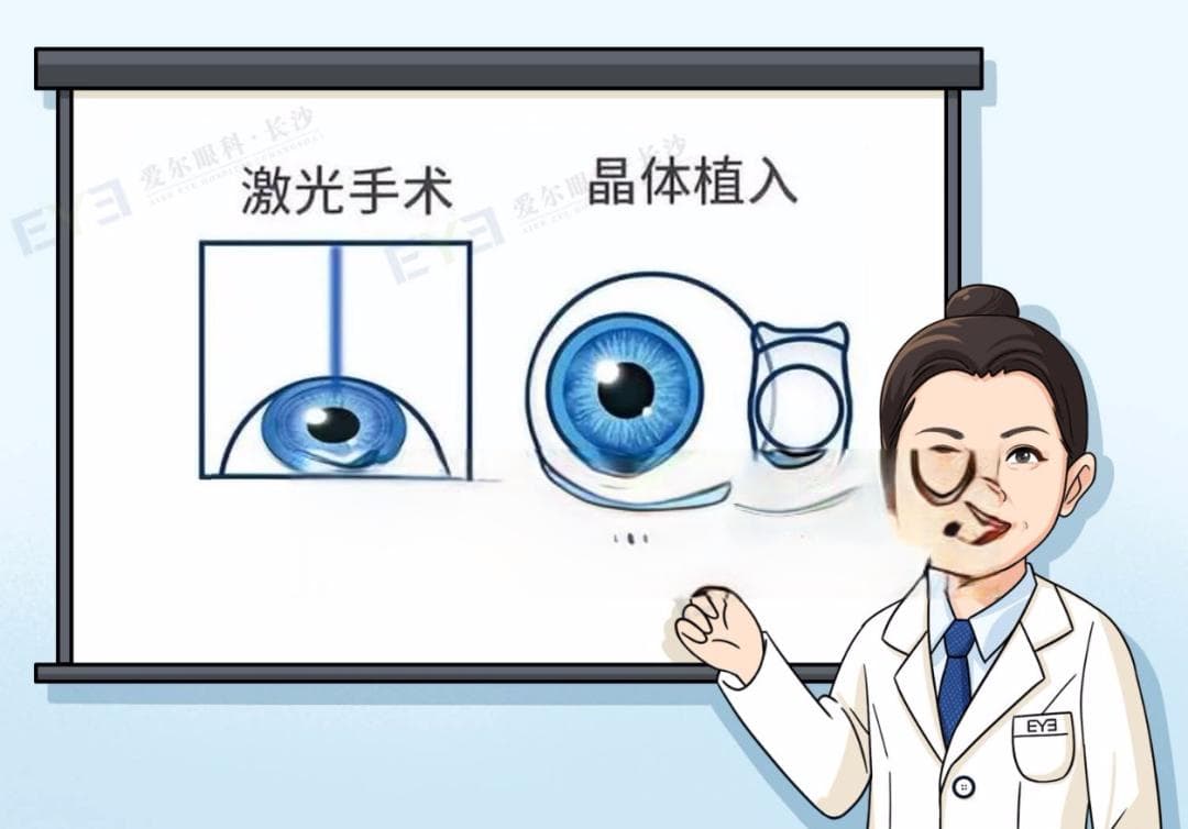 近视手术术后如何护理？谨记这8点…