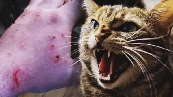 女子被爱猫咬伤后险些截肢，专家提醒：别让"小伤口"酿成大隐患