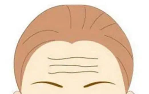 抬头纹明显怎么办？面部提升手术全解析及医生选择指南