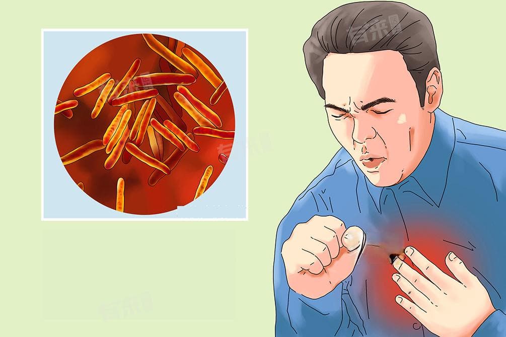 结核病的症状表现及严重性