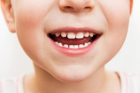 幼儿乳牙龋齿怎么办？这份科普指南请收好