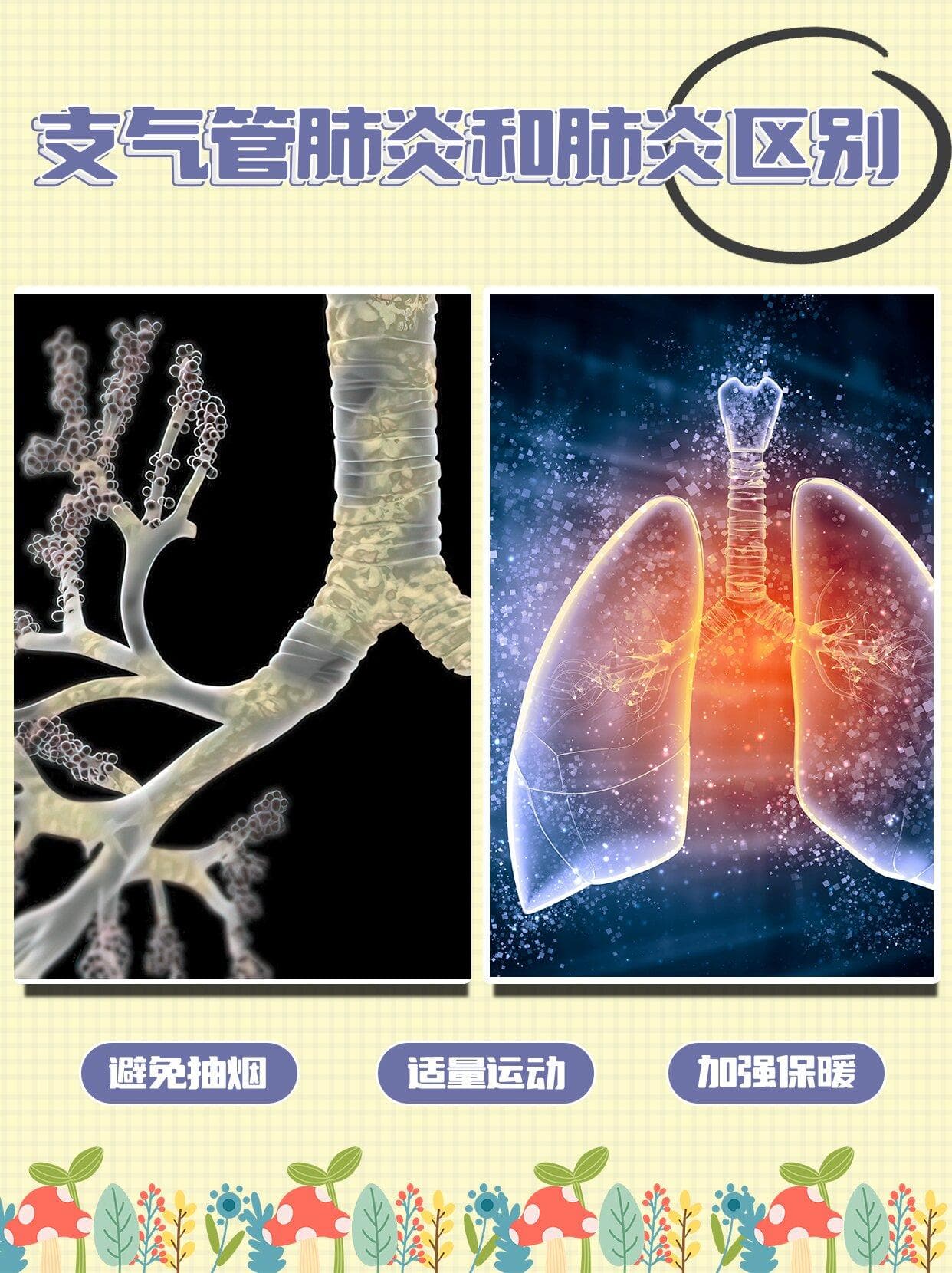 支气管肺炎与肺炎：理清两者概念