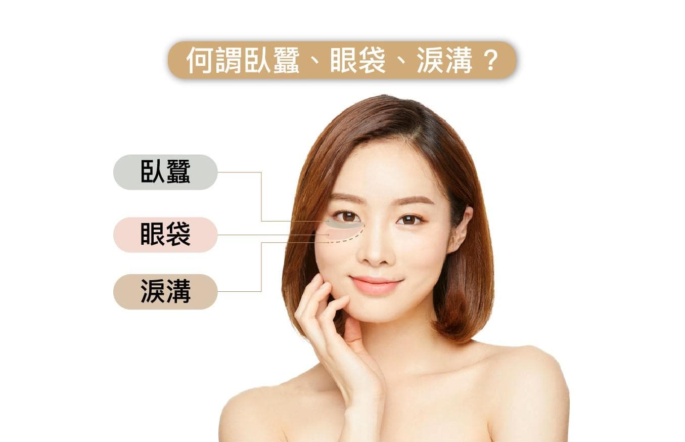 三大眼袋成因你中哪一種，2025年消除的眼袋改善方法及價格