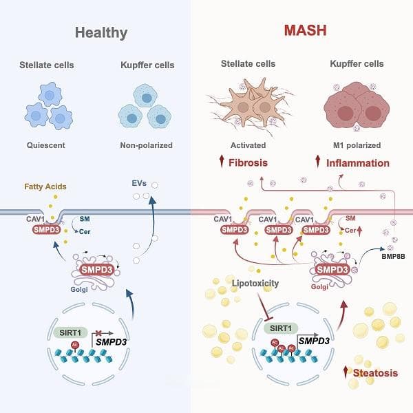 上海药物所合作揭示靶向肝细胞膜鞘脂代谢改善MASH的机制