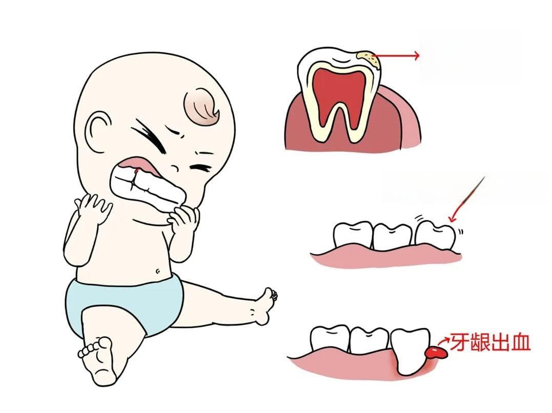孩子夜间经常磨牙怎么处理？