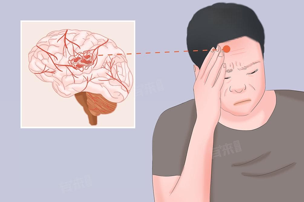 大脑里血管瘤是什么病严重吗