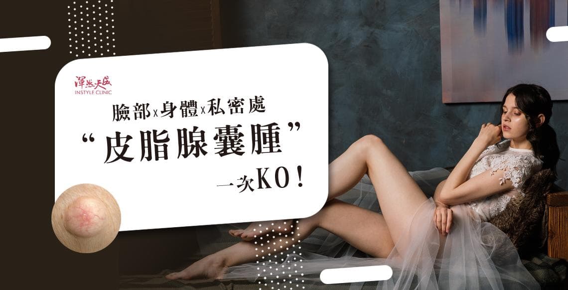 皮脂腺囊肿激光治疗全攻略：从定义到术后护理