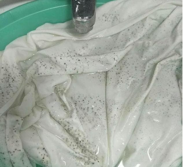 衣服发霉了怎么办？教你如何有效洗掉衣服上的霉斑