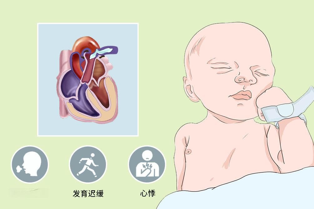 动脉导管未闭听诊杂音性质