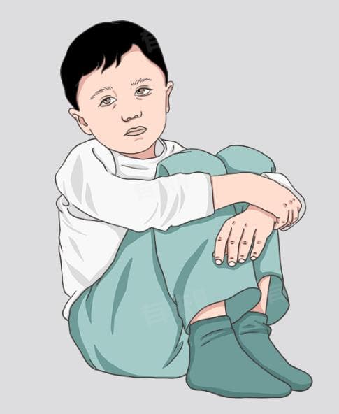 热病是什么病？西医中医的不同解读与治疗方法
