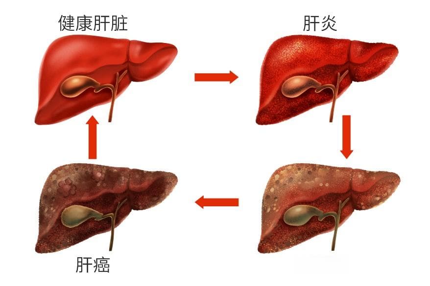 妙佑医疗国际推荐：肝功能检查的重要性
