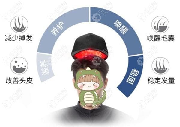 激光生发帽对脂溢性脱发/斑秃到底有用吗？是骗局还是智商税