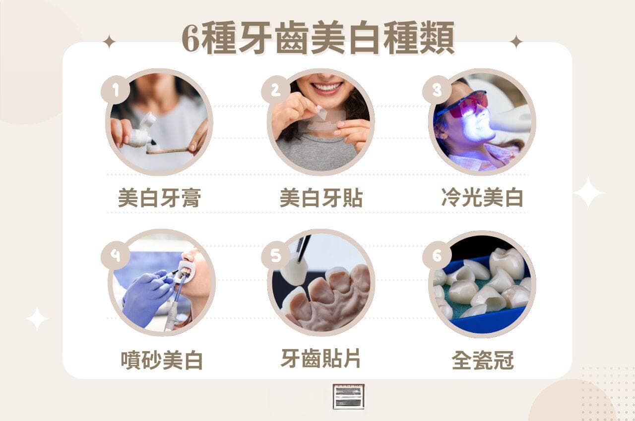 6种牙齿美白超有效！美白牙齿不可不知的妙招解惑