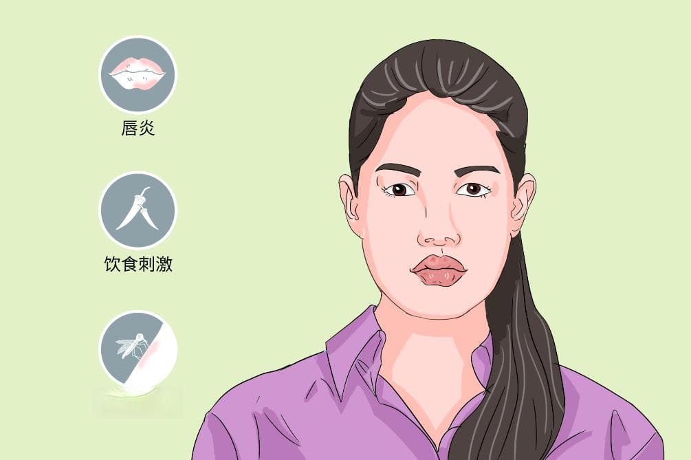 唇部肿胀：病因、症状、诊断与治疗全解析