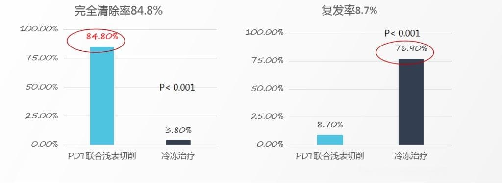 阿司匹林治跖疣？跖疣是什么原因造成的、跖疣图片初期是怎样的