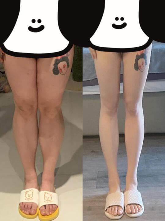 跳绳瘦身成功经验：如何科学减脂塑形