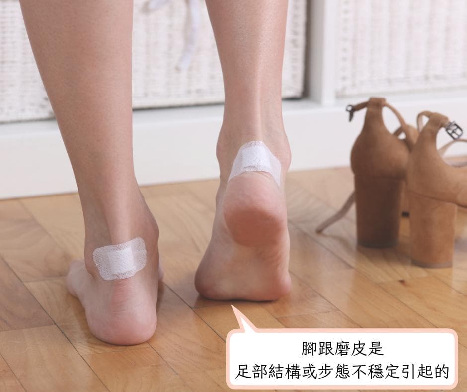 脚跟磨皮的原因与解决方案：从足部结构到鞋子选择