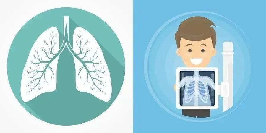 哪些人需要做肺癌早期筛查？一文详解高危人群、筛查方式及参与方法