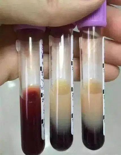 为什么我的血液颜色和别人不一样？