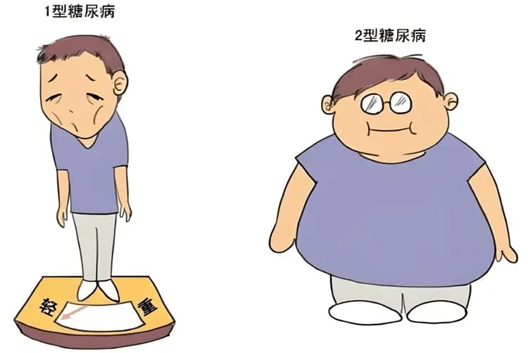 糖尿病的常见类型及诊断