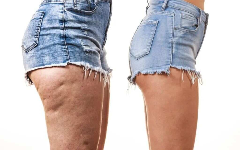 腿部健康关乎寿命？这些症状和注意事项要记牢