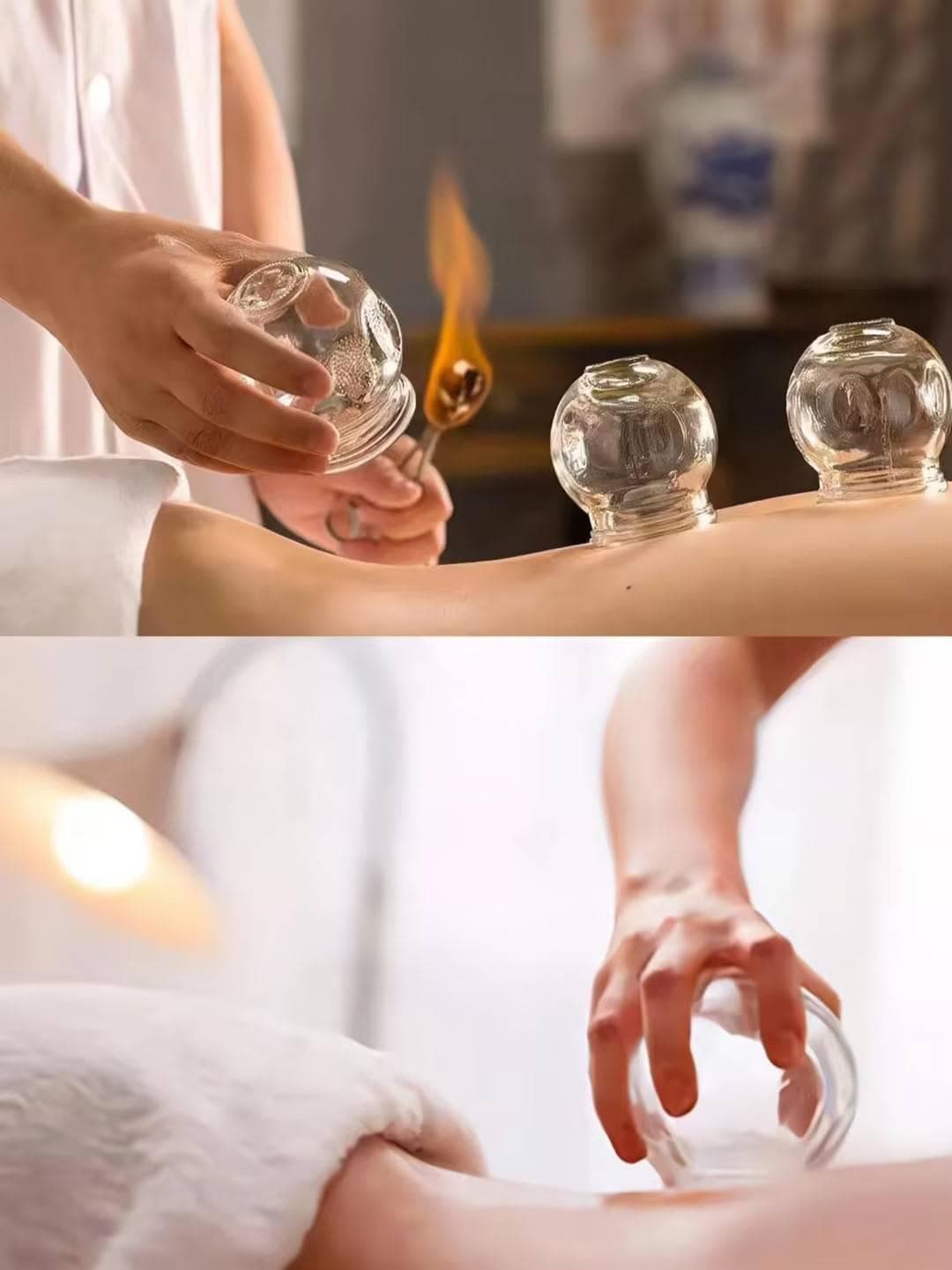 辨体质选拔罐：六种常见体质的调理指南