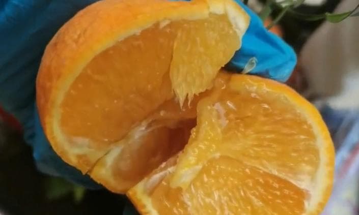 肾病患者如何科学摄入蛋白质？优质低蛋白饮食是关键！