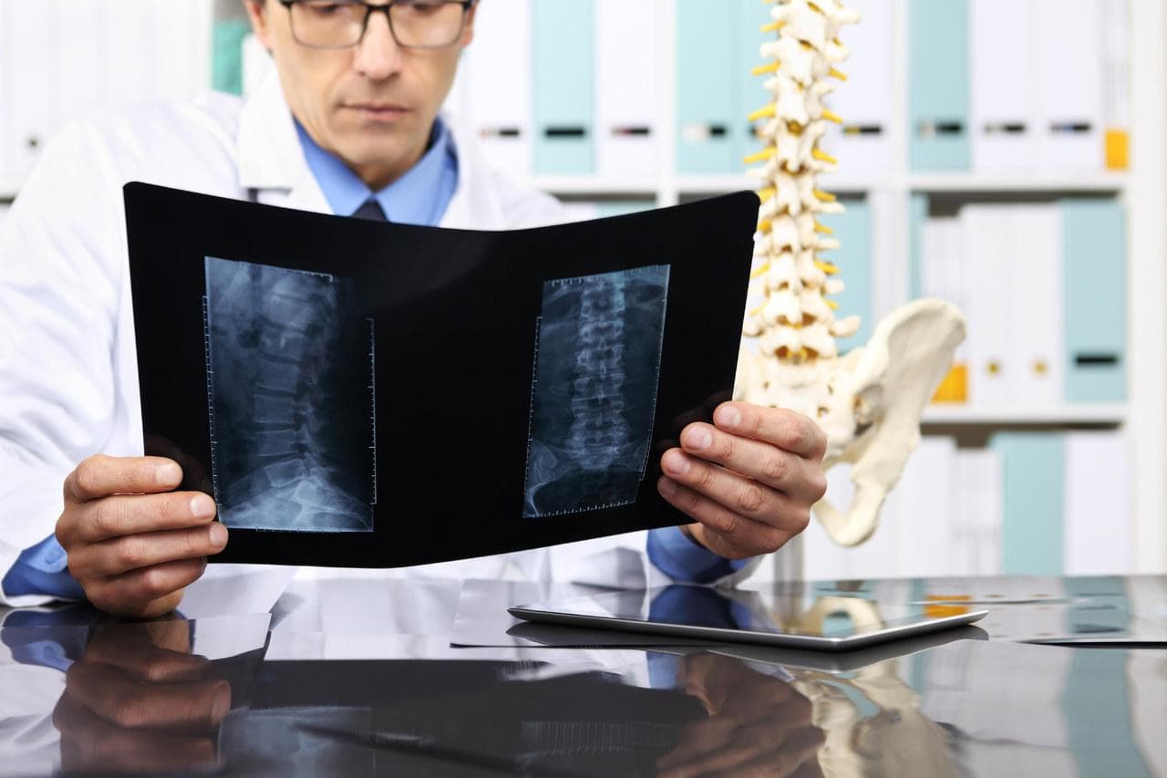 腰椎骨折后遗症有哪些可能导致瘫痪