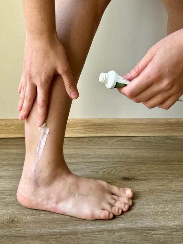 专业解析：淡化疤痕的五种主要治疗方法