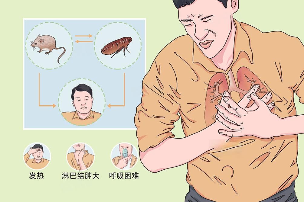 如何治疗黑死病