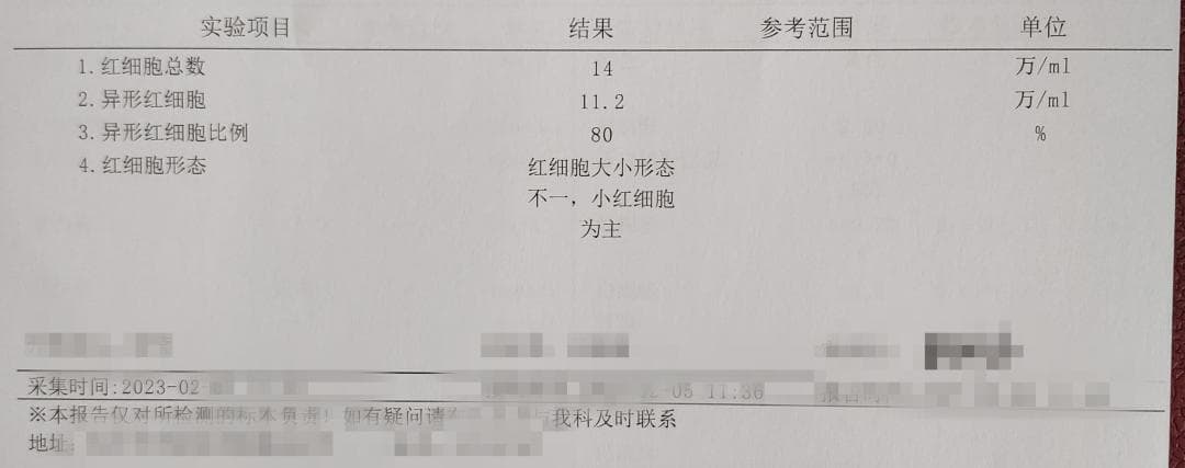 单纯胡桃夹不伤害肾，但注意肾炎常合并胡桃夹，两者同时存在