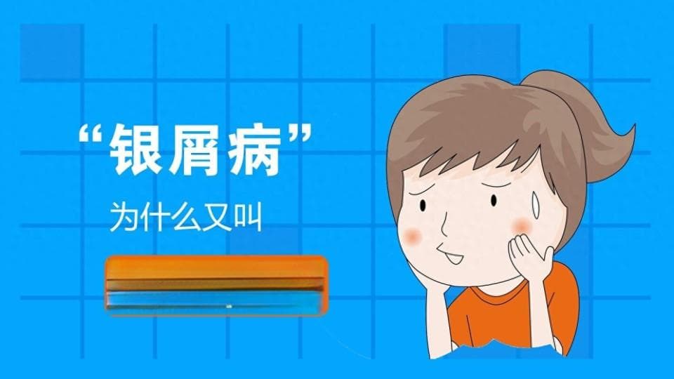 我国超过六百万人患有银屑病，日常做好4点，70%患者可控制
