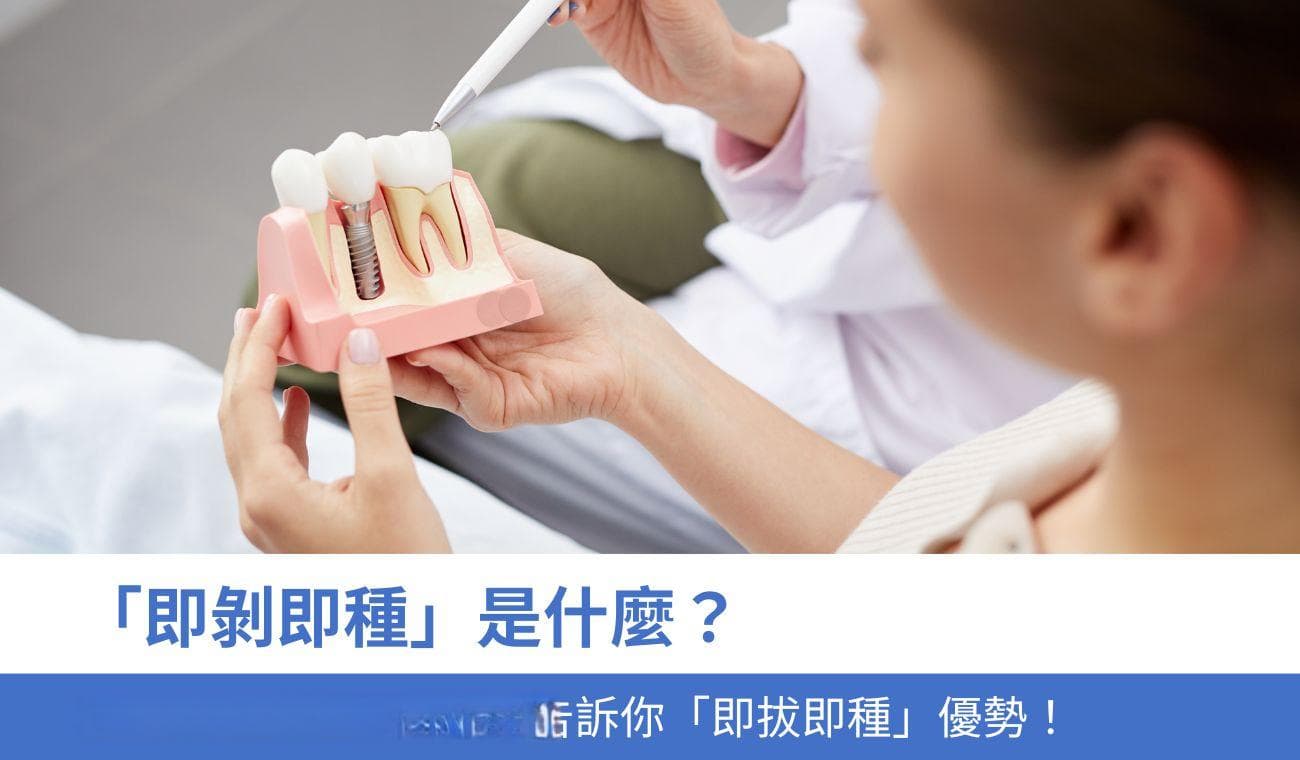 「即拔即种」是什麼？植牙治療新趨勢？牙醫告訴你4大「即拔即种」優勢！