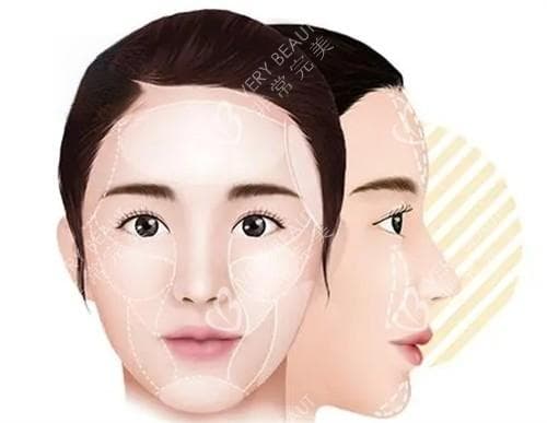 脂肪填充面部馒化怎么解决?正确处理脂肪填充引起的馒化脸,多数采用面部吸脂